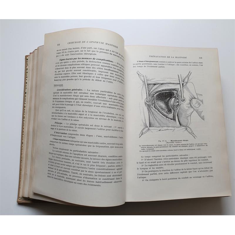 Chirurgie de l'oreille du nez du pharynx et du larynx