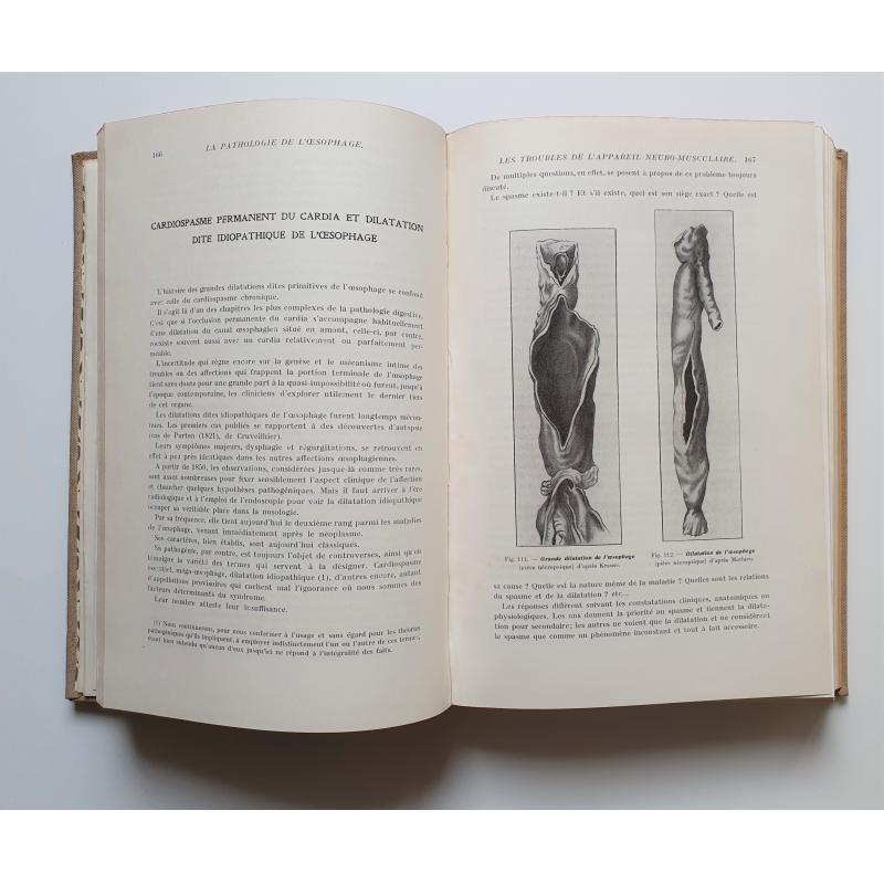 Les maladies de l'oesophage